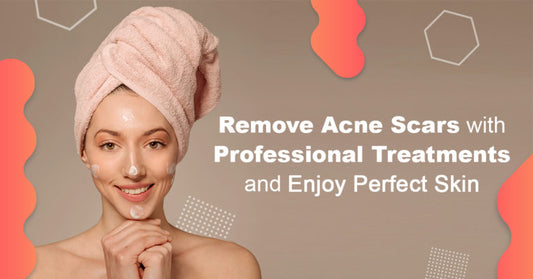 Remove Acne Scars with Professional Treatments and Enjoy Perfect Skin